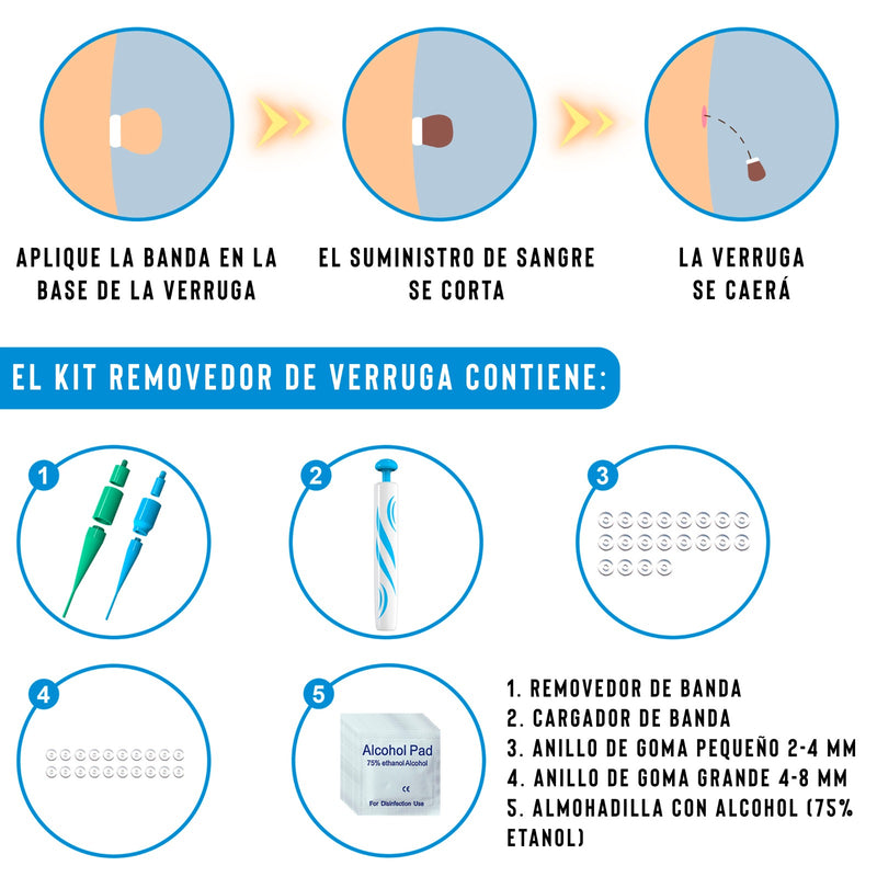 TAGBAND - Eliminación de Verrugas ( OFERTA SOLO HOY )